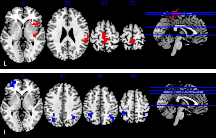 FIGURE 3