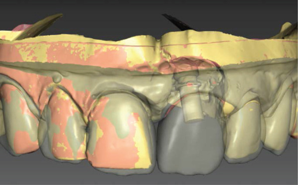 Figure 6