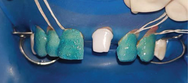 Figure 9