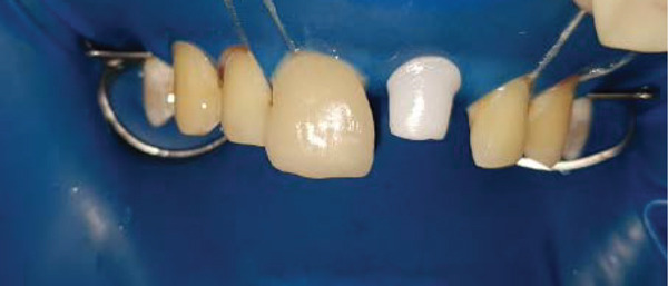 Figure 14
