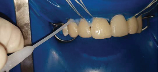 Figure 15