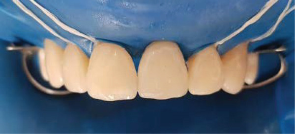 Figure 16