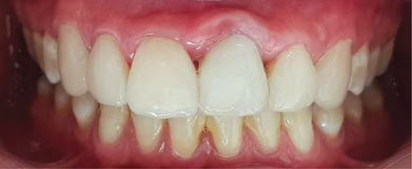 Figure 17