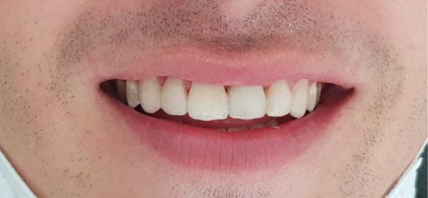 Figure 18