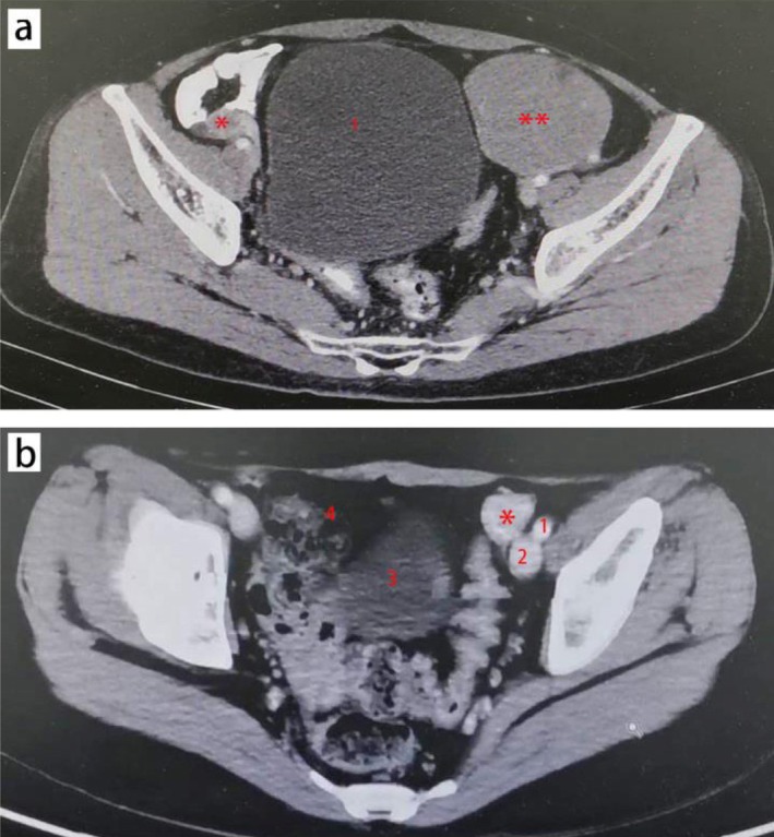 FIGURE 2