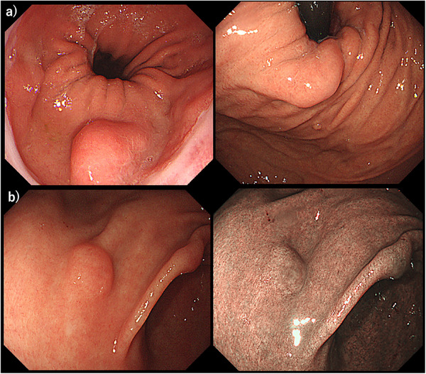 FIGURE 1