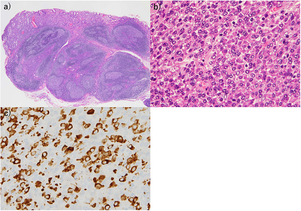FIGURE 3