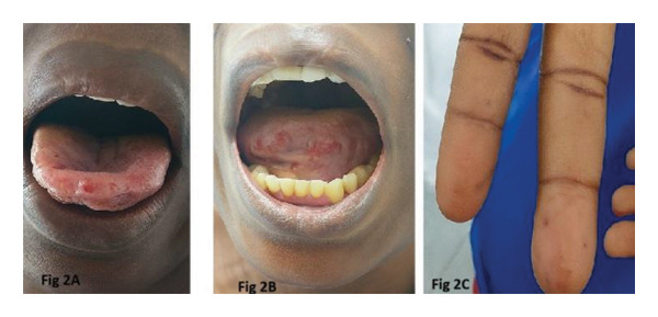 FIGURE 2