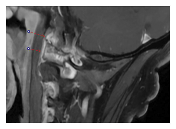 FIGURE 2