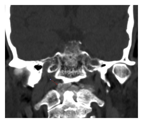 FIGURE 3