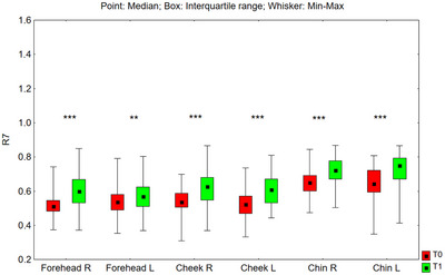 FIGURE 14