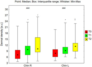 FIGURE 11