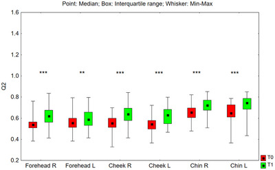 FIGURE 16