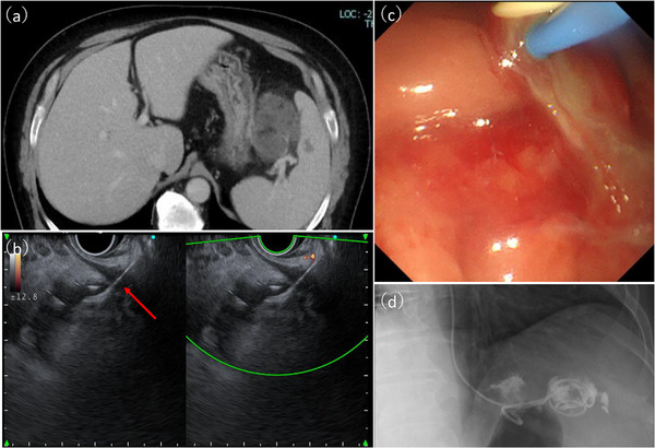 FIGURE 3