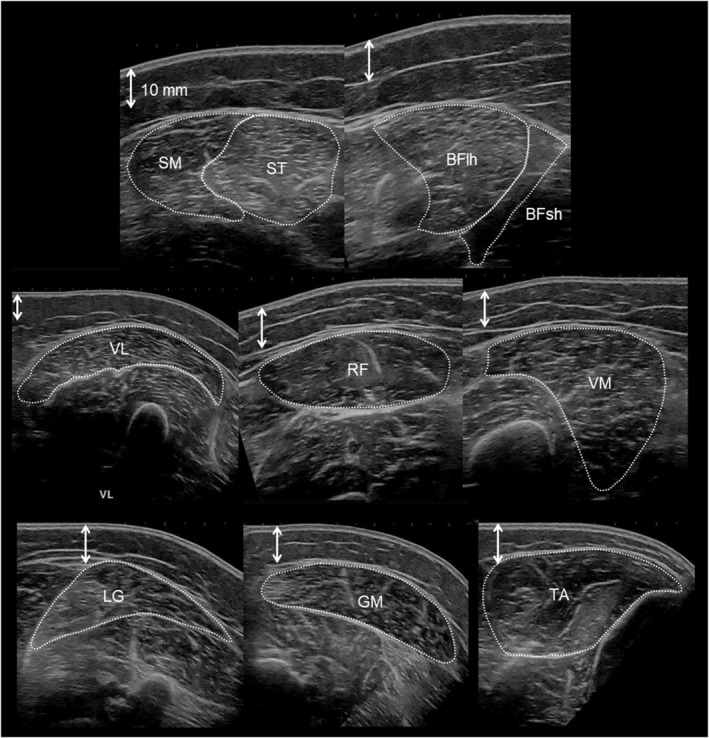 FIGURE 1