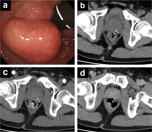 FIGURE 1
