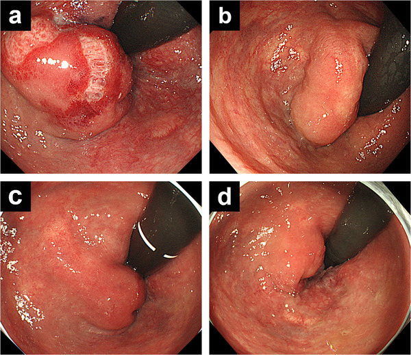 FIGURE 4