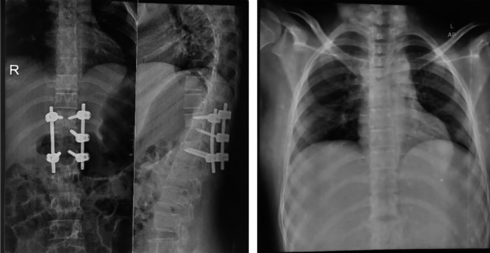 FIGURE 4