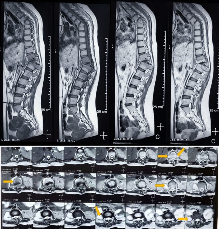 FIGURE 2