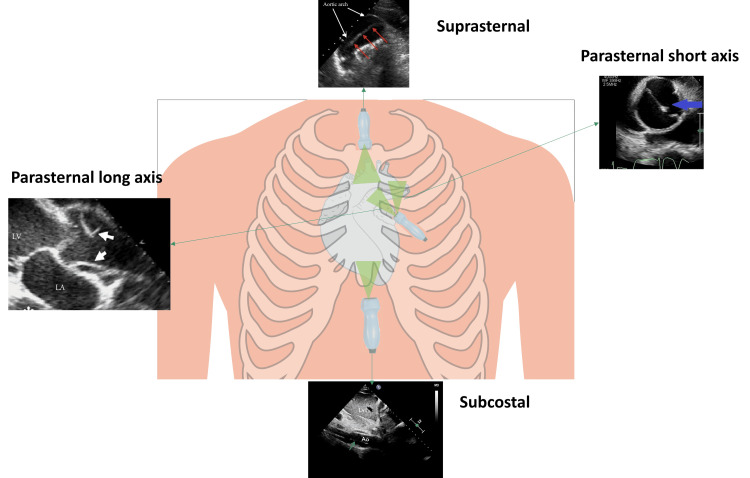 Figure 4