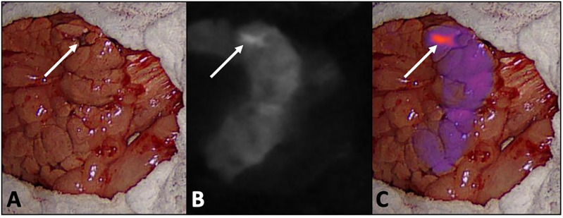 Fig 1
