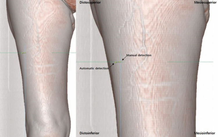 Fig 4