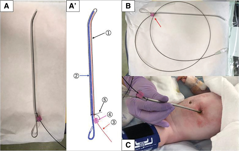 Fig. 3