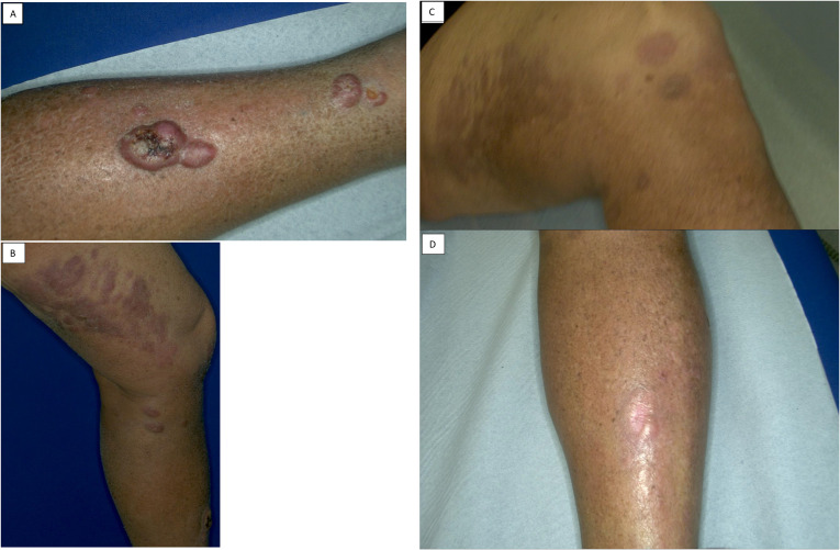 Figure 1
