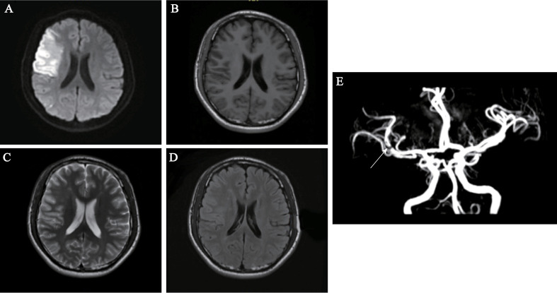 Figure 2