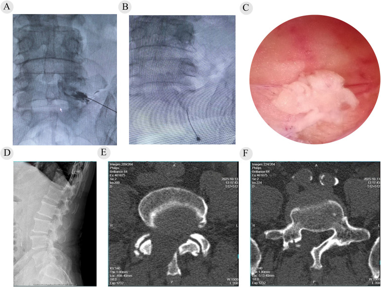 Figure 2