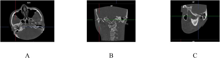 Figure 2