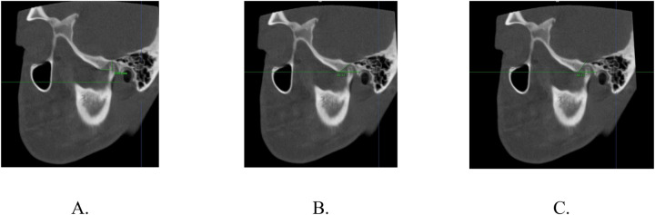 Figure 3