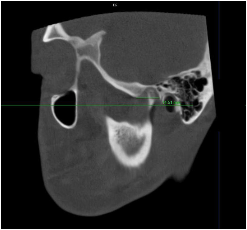 Figure 4