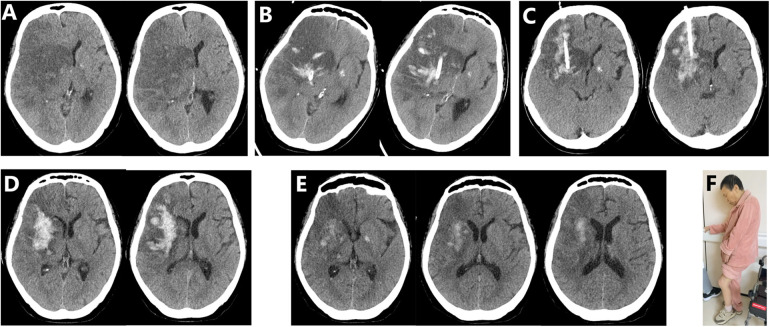 Figure 3