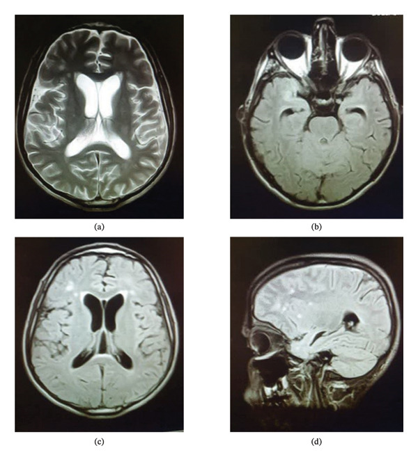 FIGURE 1