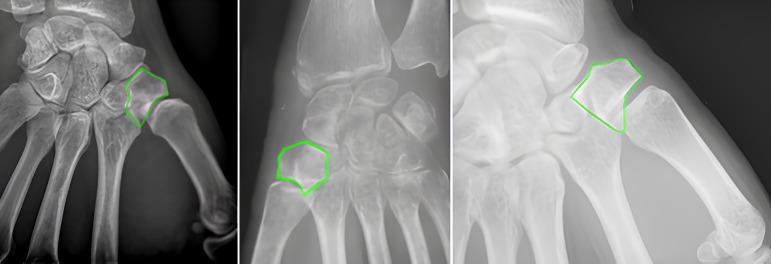 Figure 2