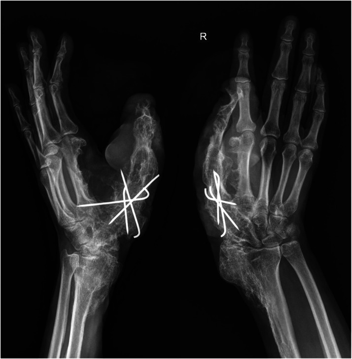 Figure 6