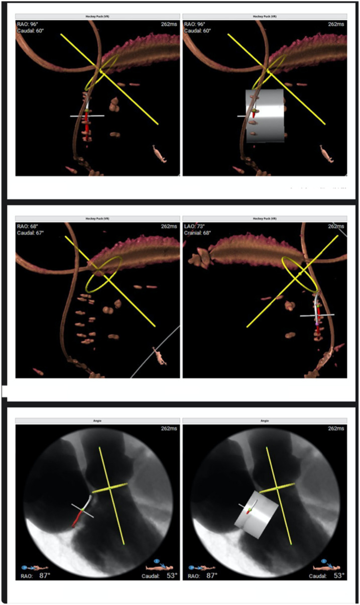 Figure 3