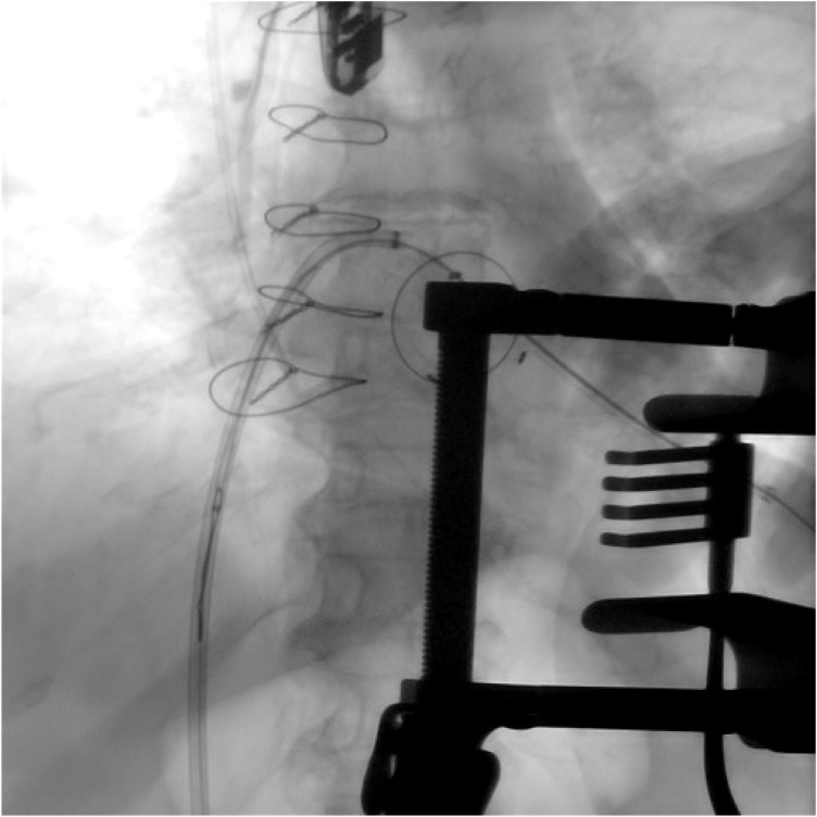 Figure 4
