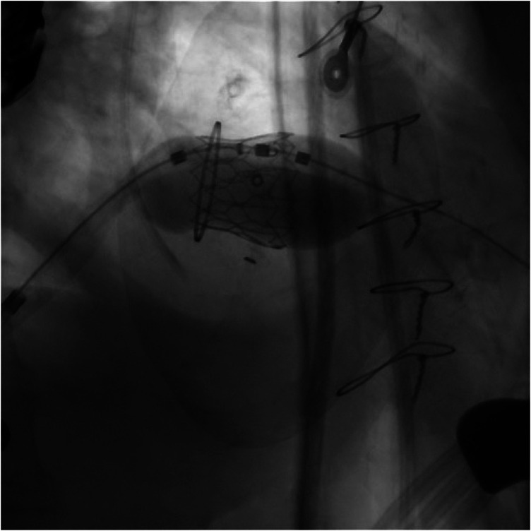 Figure 5