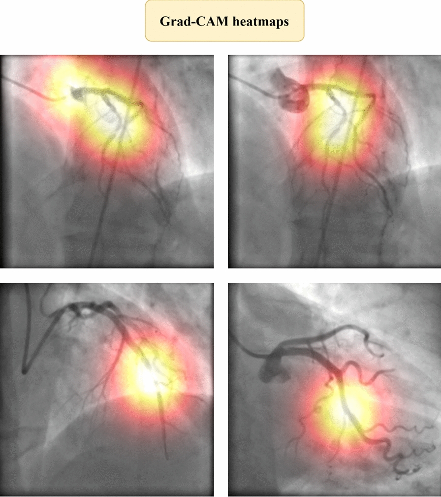Figure 17