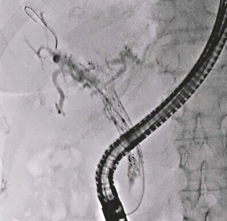 Fig. 1