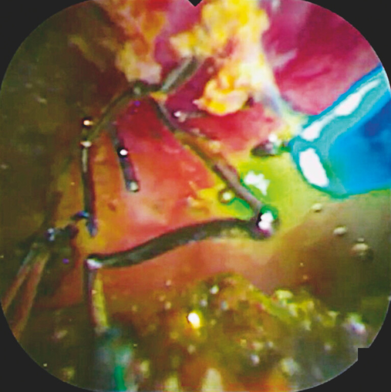 Fig. 4