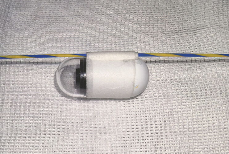 Fig. 3
