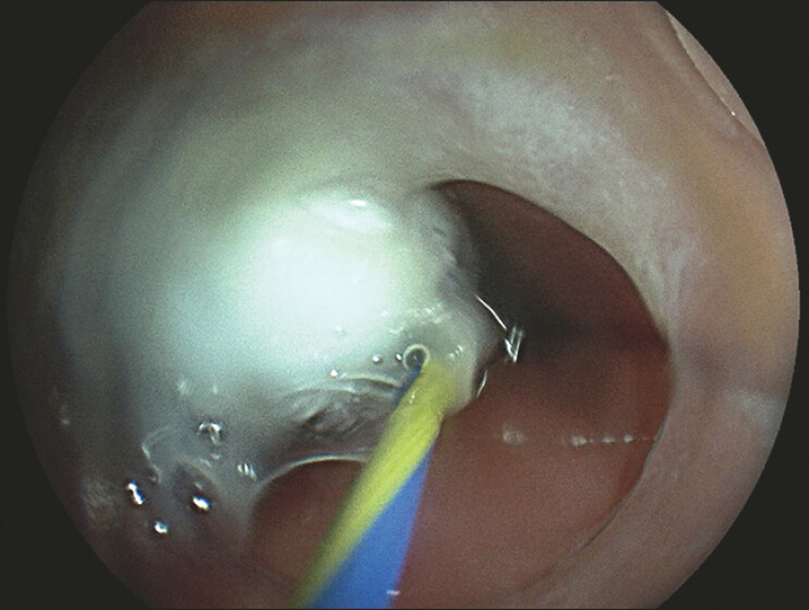 Fig. 4