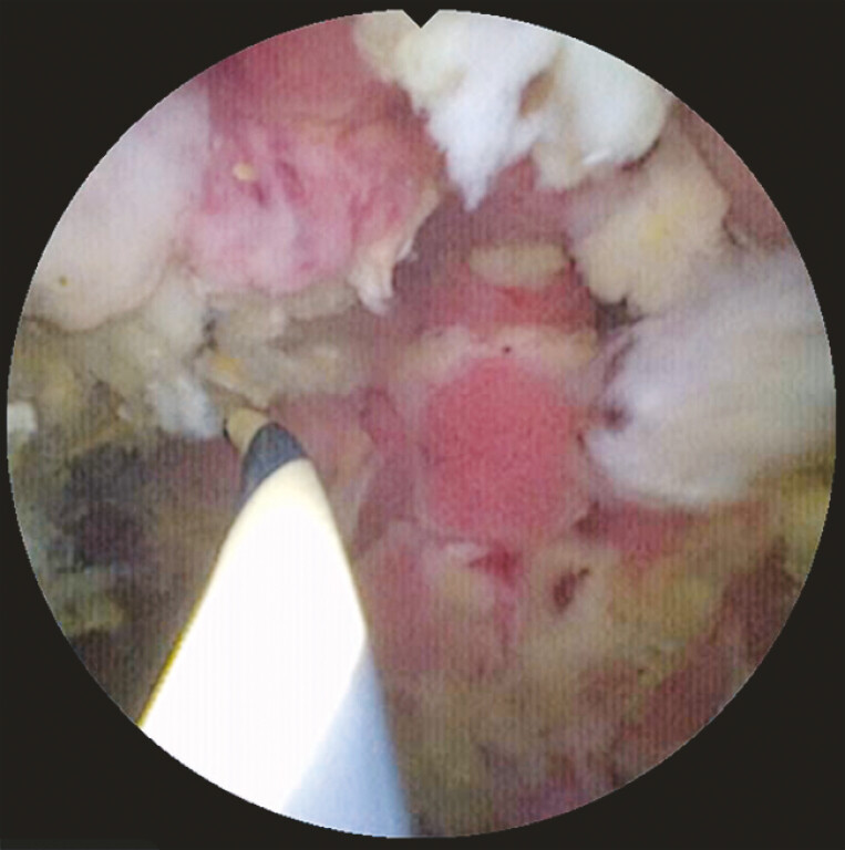 Fig. 4
