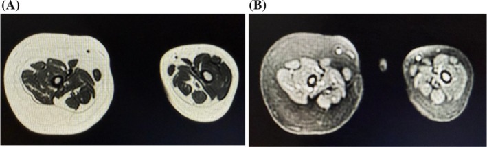 FIGURE 3
