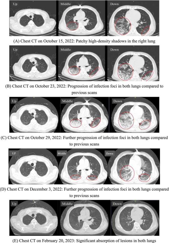 FIGURE 1