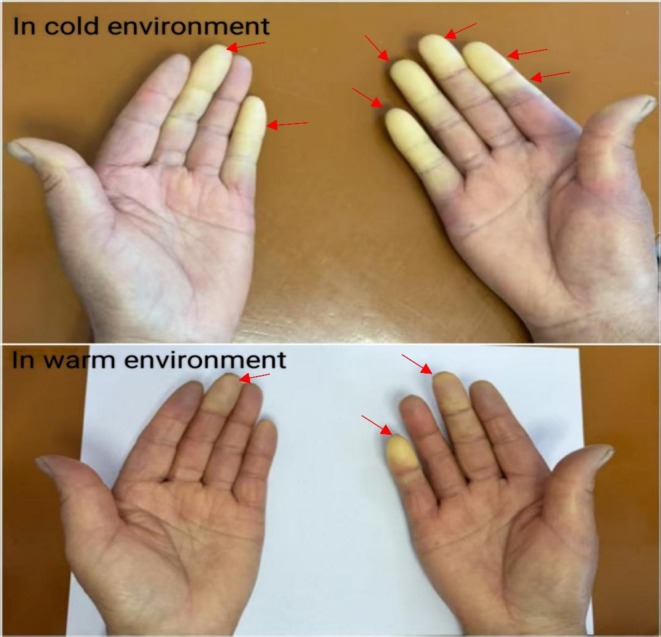 FIGURE 3