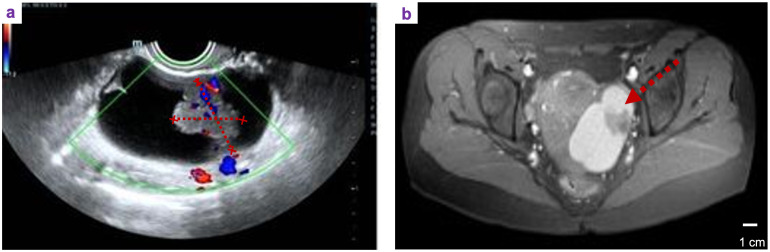 Figure 1